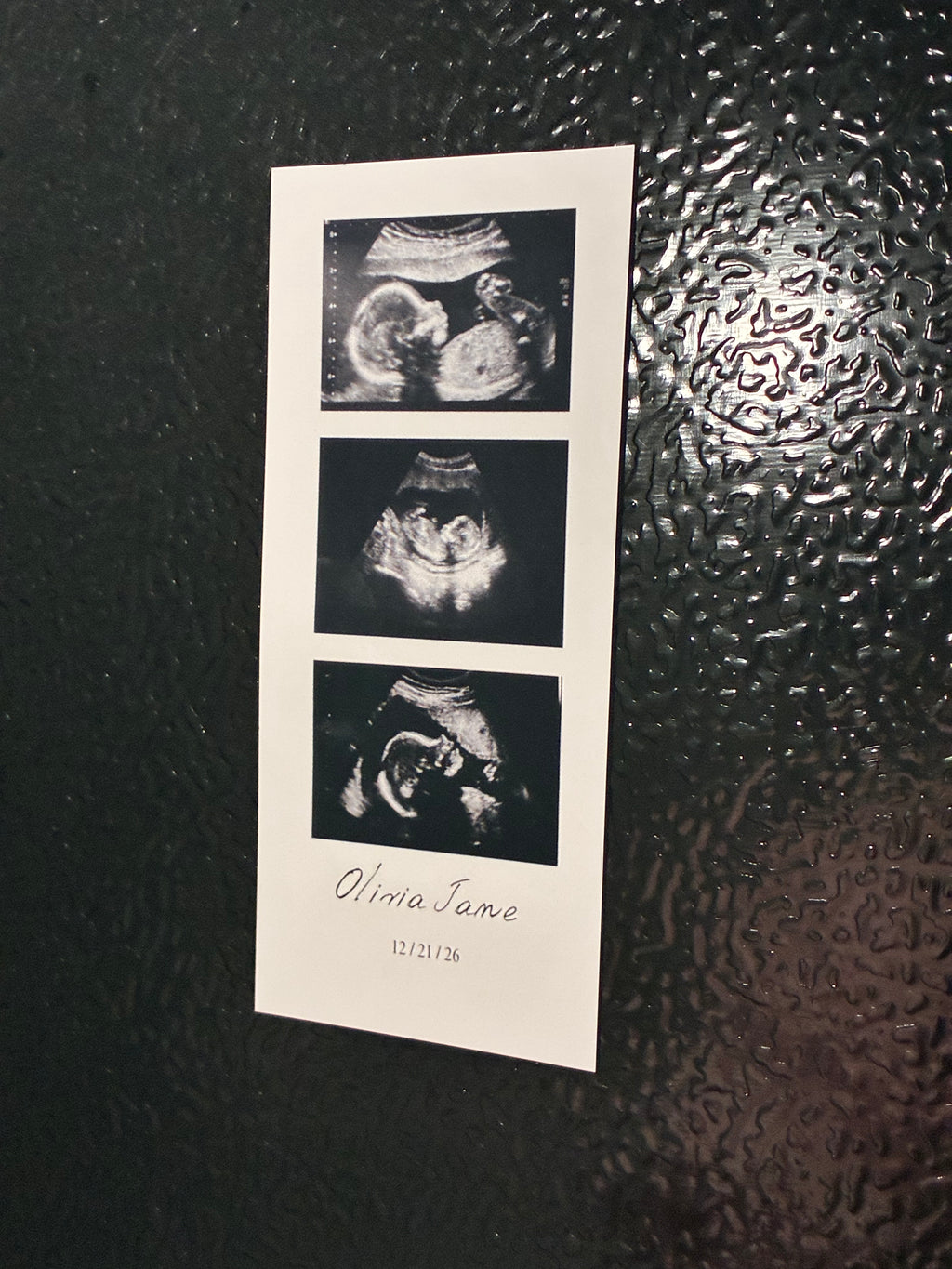 Custom Ultrasound Photo Strip Magnet - Baby Announcement Magnet